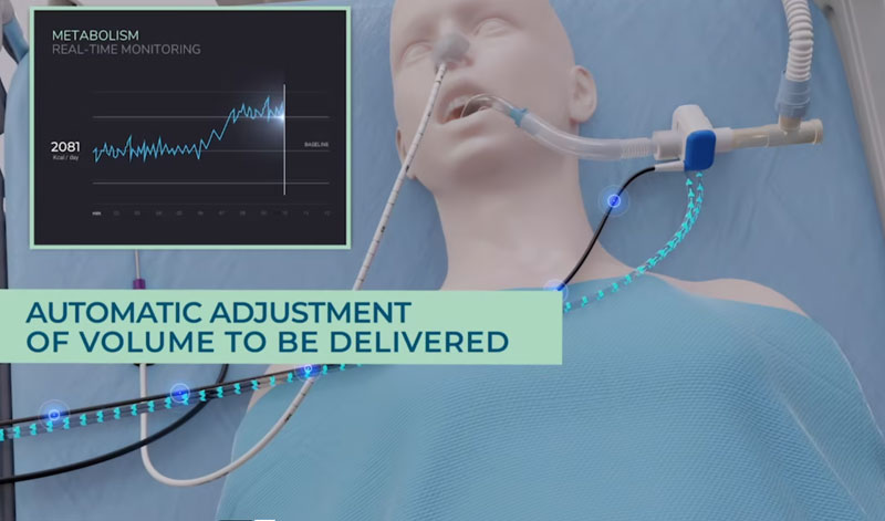 Calculating Patient Energy Needs
